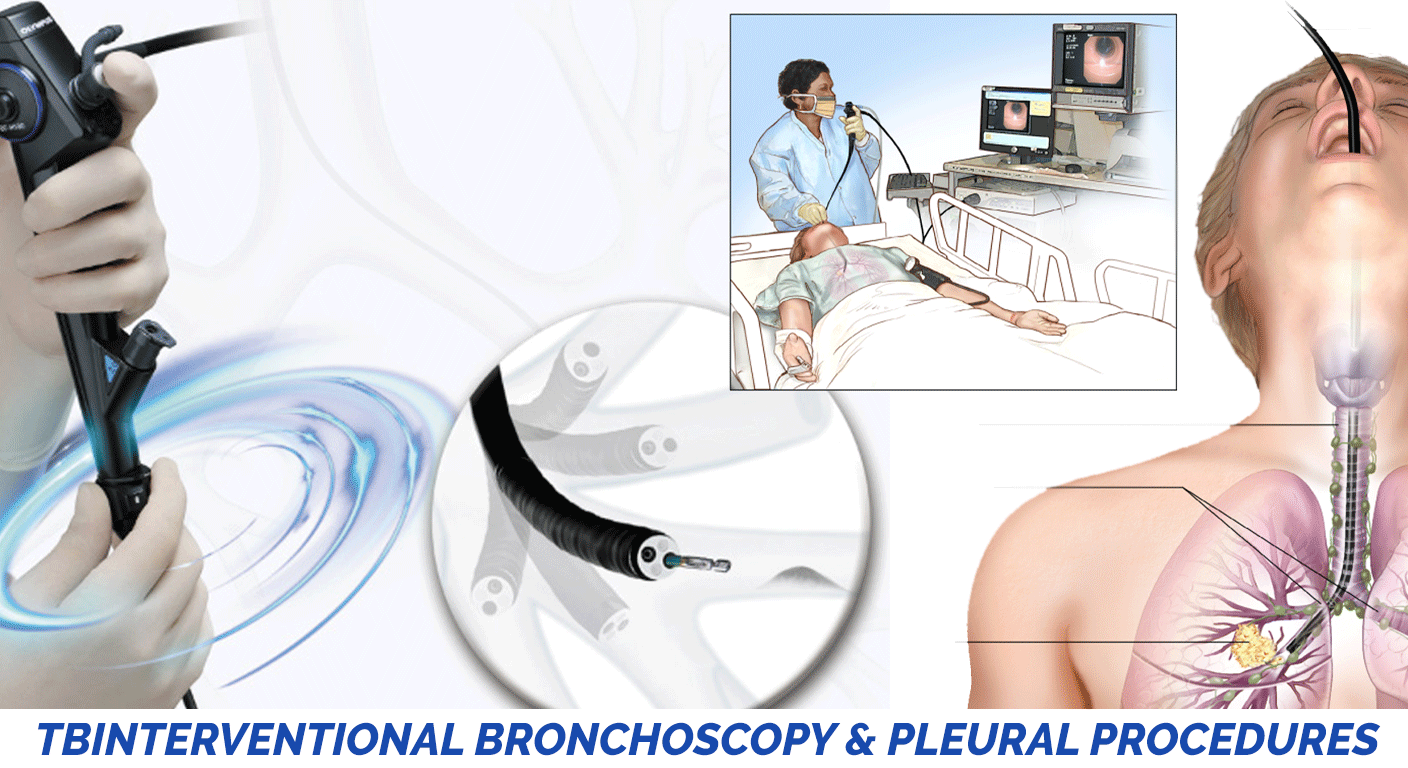 Interventional Bronchoscopy & Pleural Procedures