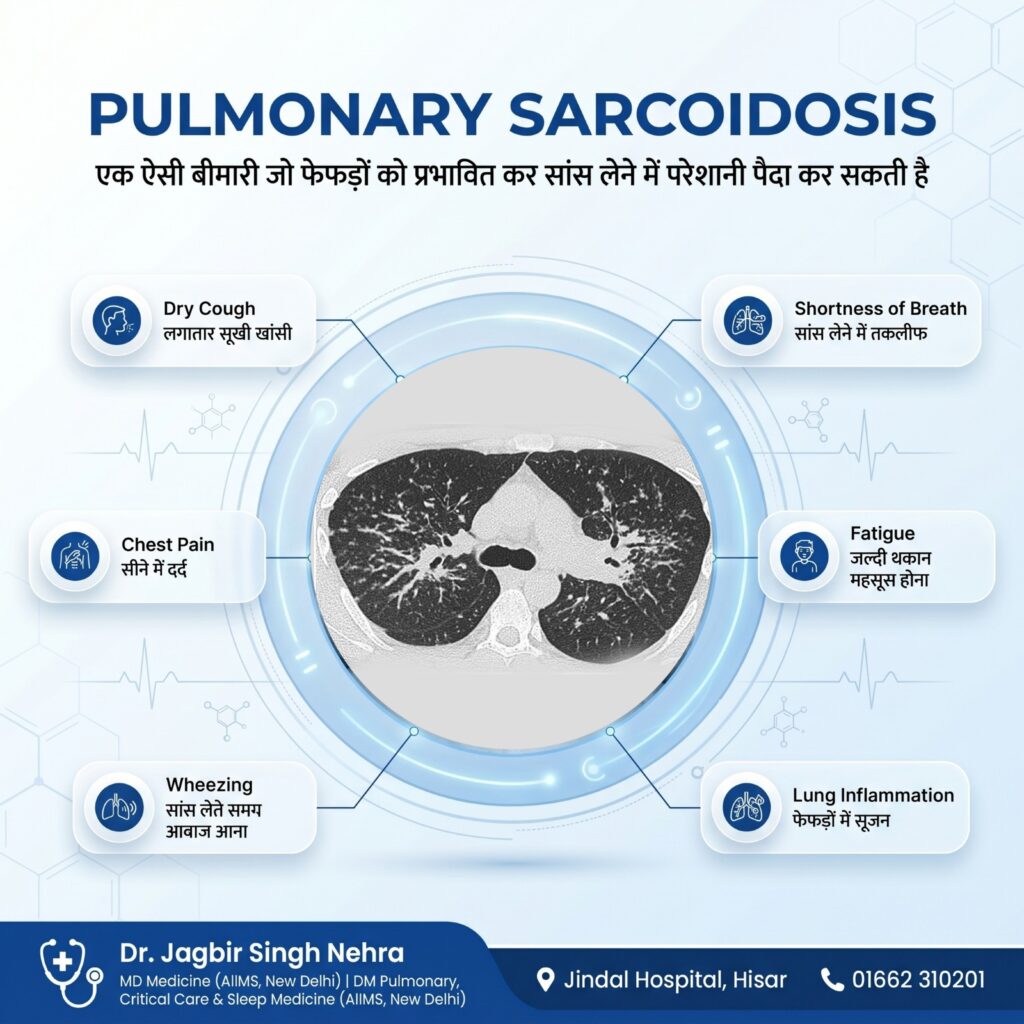 Pulmonary Sarcoidosis Treatment in Hisar